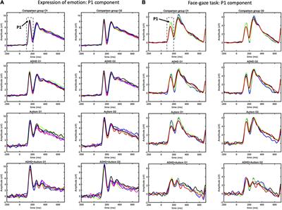 Face processing in young adults with autism and ADHD: An event related potentials study